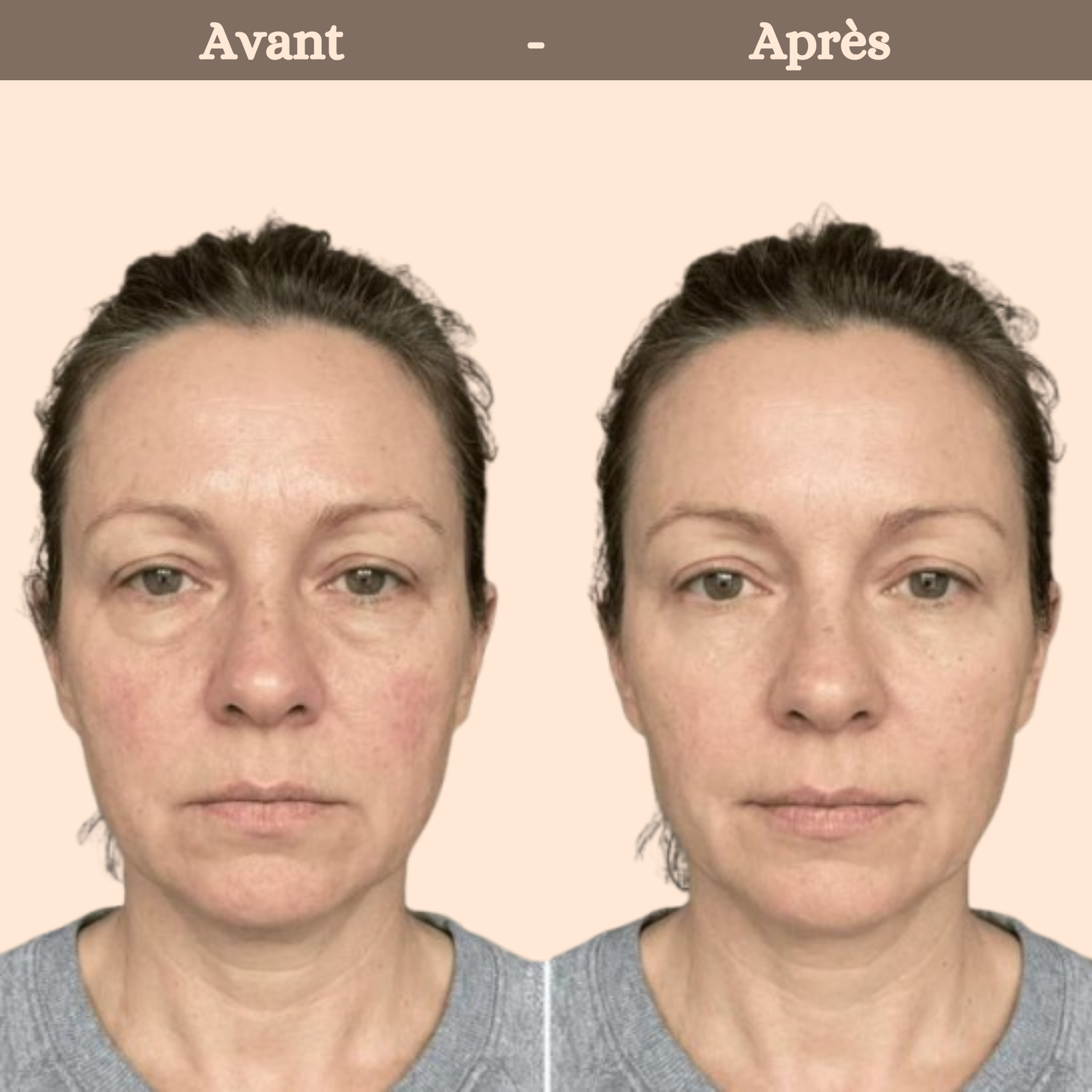 Brosse drainage lymphatique pour le visage